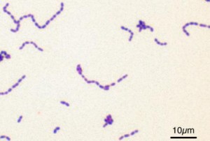 bakteri streptococcus
