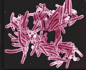 Penyakit tbc