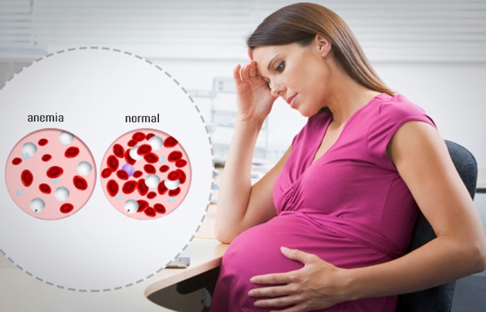 mencegah anemia pada ibu hamil aladokter
