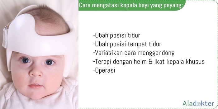 cara mengatasi kepala bayi peyang