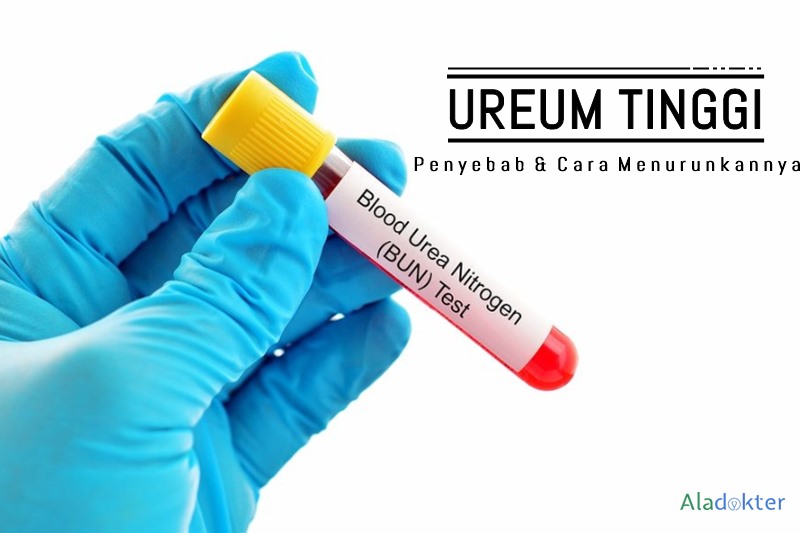 Penyebab ureum tinggi